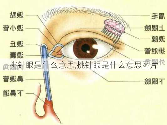 挑针眼是什么意思,挑针眼是什么意思图片