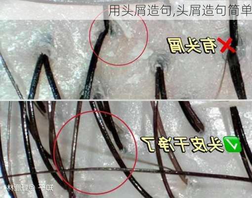 用头屑造句,头屑造句简单